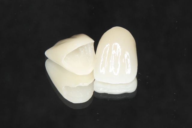 セラミック治療について